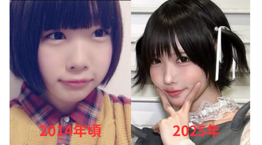 2014年頃と2025年のあのちゃんの比較