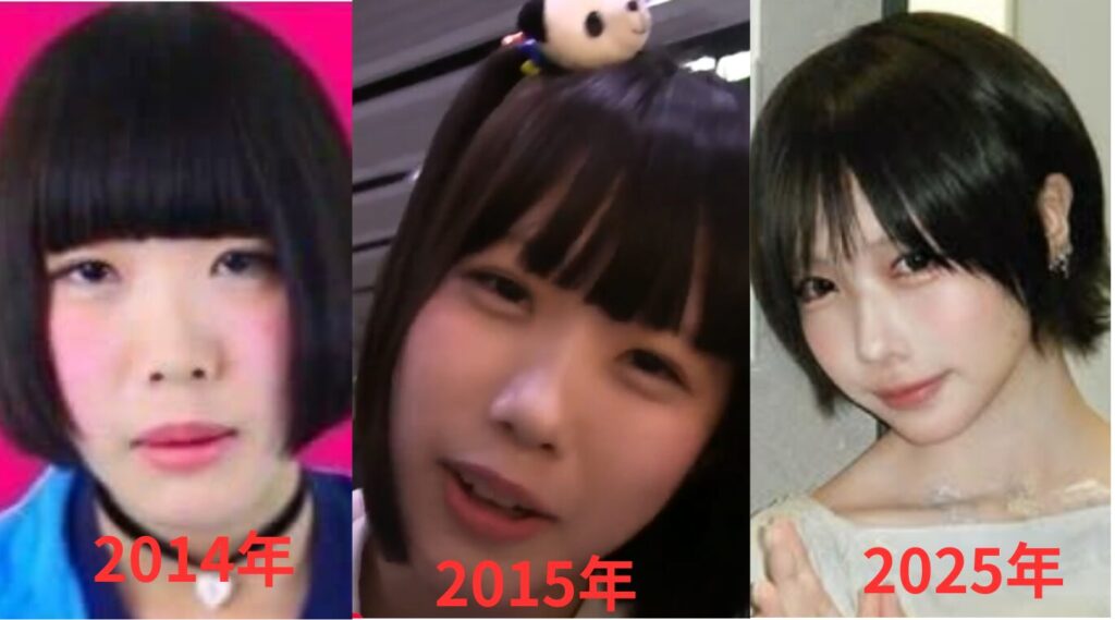 年代別
あのちゃん